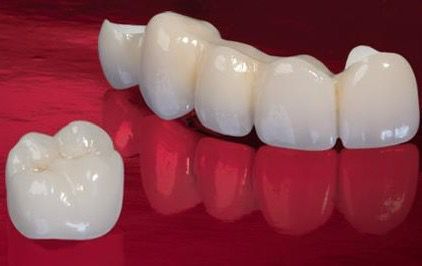 Prime Multilayer High Translucency (MHT) Zirconia Block